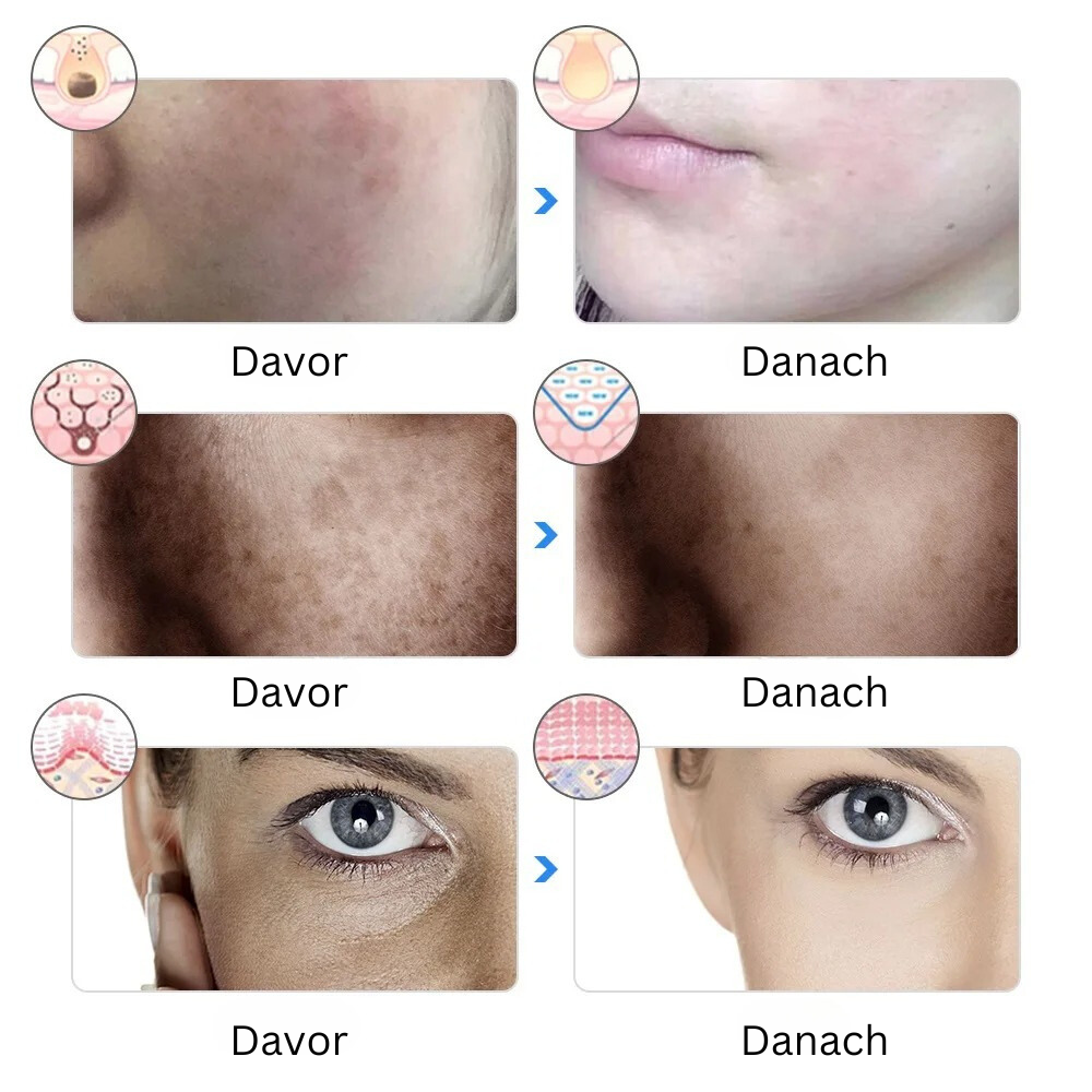 VENIVA-CLEAN-PRO® - Schöne Haut zum Verlieben